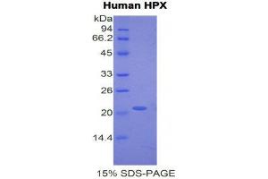 SDS-PAGE (SDS) image for Hemopexin (HPX) (AA 24-173) protein (His tag) (ABIN2121223)