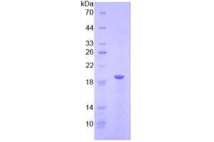 SDS-PAGE analysis of Human LPCAT3 Protein.