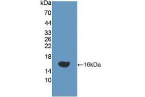 Detection of Recombinant NEP, Rat using Polyclonal Antibody to Neprilysin (CD10) (MME antibody  (AA 32-164))