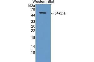 Detection of Recombinant COL5a2, Human using Polyclonal Antibody to Collagen Type V Alpha 2 (COL5a2) (COL5A2 antibody  (AA 82-308))