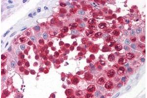 Human Testis: Formalin-Fixed, Paraffin-Embedded (FFPE) (Exportin 2 antibody  (AA 872-972))