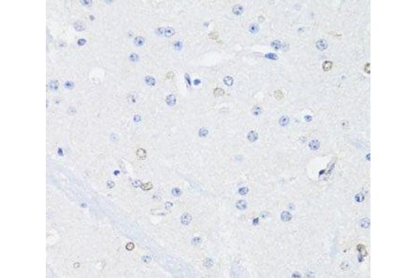SS18L1 antibody