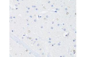 Immunohistochemistry of paraffin-embedded Mouse brain using SS18L1 Polyclonal Antibody at dilution of 1:100 (40x lens). (SS18L1 antibody)