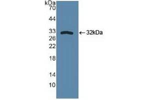 Detection of Recombinant SPHK1, Human using Polyclonal Antibody to Sphingosine Kinase 1 (SPHK1) (SPHK1 antibody  (AA 148-398))