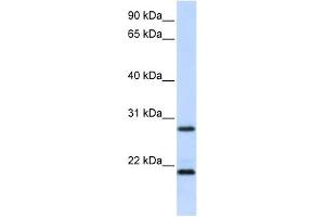 MUC1 antibody used at 1 ug/ml to detect target protein. (MUC1 antibody  (N-Term))