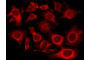 ABIN6276000 staining Hela by IF/ICC. (GPR101 antibody  (Internal Region))