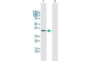 Western Blot analysis of RCBTB1 expression in transfected 293T cell line by RCBTB1 MaxPab polyclonal antibody. (RCBTB1 antibody  (AA 1-355))