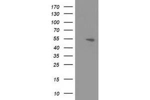 HEK293T cells were transfected with the pCMV6-ENTRY control (Left lane) or pCMV6-ENTRY APBB3 (Right lane) cDNA for 48 hrs and lysed. (APBB3 antibody)