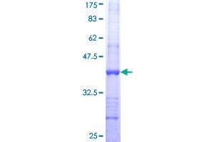 ST3GAL4 Protein (AA 31-130) (GST tag)