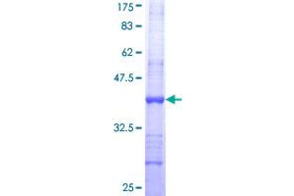 ST3GAL4 Protein (AA 31-130) (GST tag)