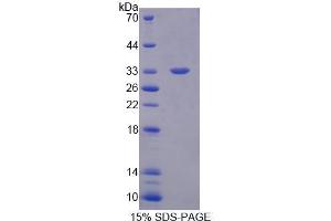 SDS-PAGE analysis of Human PLCb2 Protein. (Phospholipase C beta 2 Protein)