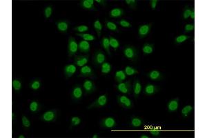 Immunofluorescence of monoclonal antibody to GATA2 on HeLa cell. (GATA2 antibody  (AA 1-102))