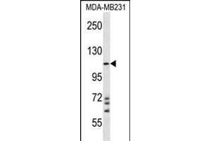 NLRC4 Antibody (N-term) (ABIN657230 and ABIN2846332) western blot analysis in MDA-M cell line lysates (35 μg/lane). (NLRC4 antibody  (N-Term))