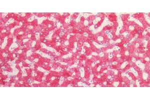 Immunohistochemistry of paraffin-embedded Human liver using PCK1 Polyclonal Antibody at dilution of 1:100. (PCK1 antibody)