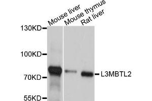 Western blot analysis of extracts of various cell lines, using L3MBTL2 antibody (ABIN5998104) at 1/1000 dilution. (L3MBTL2 antibody)