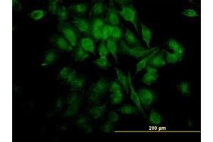 Immunofluorescence (IF) image for anti-Nuclear Factor-kB p65 (NFkBP65) (AA 432-505) antibody (ABIN562624)