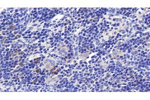 Detection of RNASE2 in Rat Spleen Tissue using Polyclonal Antibody to Ribonuclease A2 (RNASE2) (RNASE2 antibody  (AA 26-155))