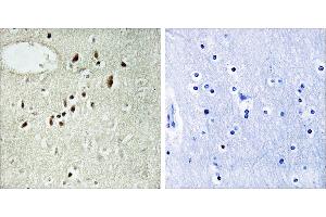 Peptide - +Immunohistochemistry analysis of paraffin-embedded human brain tissue, using EMX2 antibody. (EMX2 antibody)