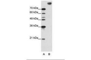 Image no. 1 for anti-Pre-mRNA Branch Site Protein p14 (SF3B14) (AA 131-180) antibody (ABIN203254) (Pre-mRNA Branch Site Protein p14 (SF3B14) (AA 131-180) antibody)