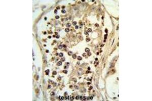 Immunohistochemistry (IHC) image for anti-Abhydrolase Domain Containing 12 (ABHD12) antibody (ABIN3003955) (ABHD12 antibody)