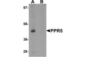 Western blot analysis of PRR5 in SK-N-SH cell lysate with PRR5 antibody at 1 μg/ml in (A) the absence and (B) the presence of blocking peptide (PRR5 antibody  (C-Term))