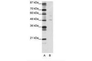 Image no. 1 for anti-Pleiomorphic Adenoma Gene-Like 1 (PLAGL1) (N-Term) antibody (ABIN202463) (PLAGL1 antibody  (N-Term))