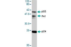 Detection of HIV-1 p24 and precursor proteins p55 and p41 by Western blotting using the HIV-1 Gag p24 polyclonal antibody  . (HIV-1 p24 antibody)
