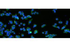 Immunofluorescence analysIs ofNCCIT cell using VMA21 Polyclonal Antibody at dilution of 1:50 (VMA21 antibody)