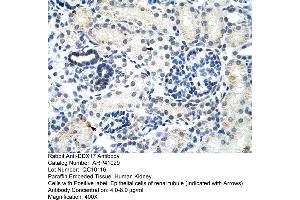 Rabbit Anti-DDX17 Antibody  Paraffin Embedded Tissue: Human Kidney Cellular Data: Epithelial cells of renal tubule Antibody Concentration: 4. (DDX17 antibody  (N-Term))