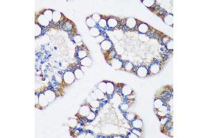 Immunohistochemistry of paraffin-embedded Human colon using TRIM62 Rabbit pAb (ABIN7270996) at dilution of 1:100 (40x lens). (TRIM62 antibody  (AA 120-280))