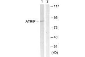 Western blot analysis of extracts from NIH-3T3 cells, using ATRIP (Ab-68/72) Antibody. (ATRIP antibody  (AA 34-83))