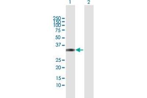 Western Blot analysis of DKK4 expression in transfected 293T cell line by DKK4 MaxPab polyclonal antibody. (DKK4 antibody  (AA 1-224))