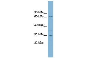 TBCCD1 antibody used at 1 ug/ml to detect target protein.