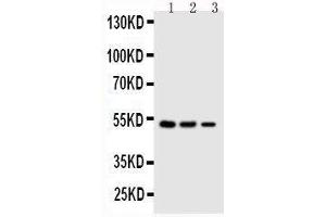 Anti-Kallistatin antibody, Western blotting Lane 1: SMMC Cell Lysate Lane 2: COLO320 Cell Lysate Lane 3: JURKAT Cell Lysate (SERPINA4 antibody  (C-Term))