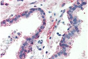 Human Prostate (formalin-fixed, paraffin-embedded) stained with ITGB1 antibody ABIN364255 at 10 ug/ml followed by biotinylated anti-mouse IgG secondary antibody ABIN481714, alkaline phosphatase-streptavidin and chromogen. (ITGB1 antibody)