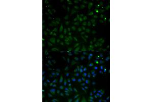 Immunofluorescence analysis of HeLa cells using VDAC1 antibody. (VDAC1 antibody)