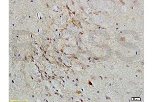 Formalin-fixed and paraffin-embedded rat brain labeled with Rabbit Anti-Versican Polyclonal Antibody, Unconjugated (ABIN741660) 1:200 followed by conjugation to the secondary antibody and DAB staining (Versican antibody  (AA 3301-3396))