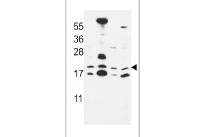 Western blot analysis in MCF-7,NCI-H460,HepG2,Hela cell line lysates (35ug/lane). (CNPY2/MSAP antibody  (C-Term))