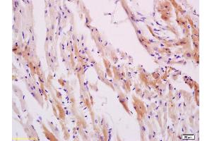 Formalin-fixed and paraffin embedded smooth muscle of rat stomach labeled with Anti-Phospho-HSP27(Ser78) Polyclonal Antibody, Unconjugated (ABIN685303) at 1:200 followed by conjugation to the secondary antibody and DAB staining (HSP27 antibody  (pSer78))