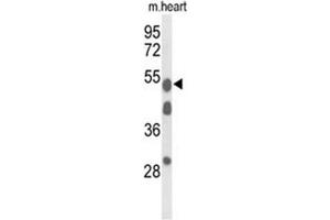 Western blot analysis of A1BG Antibody (Center) in mouse heart tissue lysates (35 µg/lane). (A1BG antibody  (Middle Region))