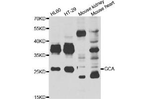 Western blot analysis of extracts of various cell lines, using GCA antibody (ABIN5974261) at 1/1000 dilution. (Grancalcin antibody)