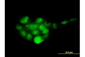 Immunofluorescence of monoclonal antibody to PSMD14 on A-431 cell. (PSMD14 antibody  (AA 1-95))