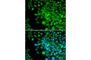 Immunofluorescence analysis of HeLa cells using FHL1 antibody (ABIN5973173). (FHL1 antibody)