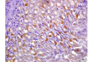 Formalin-fixed and paraffin embedded mouse stomach labeled with Anti-phospho-CaMK2 alpha (Tyr231) Polyclonal Antibody, Unconjugated (ABIN683848) at 1:200 followed by conjugation to the secondary antibody and DAB staining (CAMK2B antibody  (pTyr230))