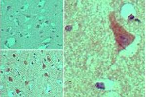 Image no. 1 for anti-ArfGAP with GTPase Domain, Ankyrin Repeat and PH Domain 2 (AGAP2) (AA 20-60) antibody (ABIN960073) (AGAP2 antibody  (AA 20-60))