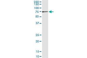 Immunoprecipitation of MPP2 transfected lysate using anti-MPP2 monoclonal antibody and Protein A Magnetic Bead , and immunoblotted with MPP2 MaxPab rabbit polyclonal antibody. (MPP2 antibody  (AA 1-552))