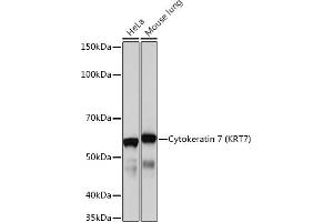 Western blot analysis of extracts of various cell lines, using Cytokeratin 7 (KRT7) (KRT7) Rabbit mAb  at 1:1000 dilution. (Cytokeratin 7 antibody)