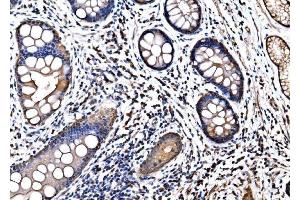 IHC analysis of HSPA6 using anti-HSPA6 antibody (ABIN7601944).
