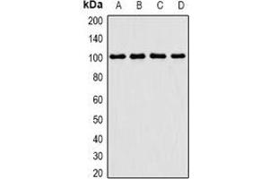 Western blot analysis of PIMT expression in Jurkat (A), MCF7 (B), mouse thymus (C), mouse testis (D) whole cell lysates. (PCMT1 antibody)