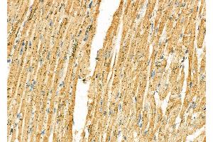 ABIN6265015 and ABIN6277239 at 1/100 staining Rat heart tissue by IHC-P.